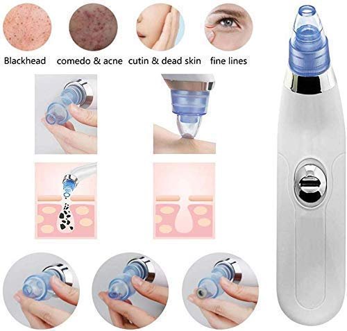 Blackheads Remover | Blackheads Extractor Derma Suction