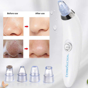 Blackheads Remover | Blackheads Extractor Derma Suction